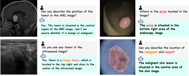Sample PRS-Med QA pairs and segmentation masks across modalities