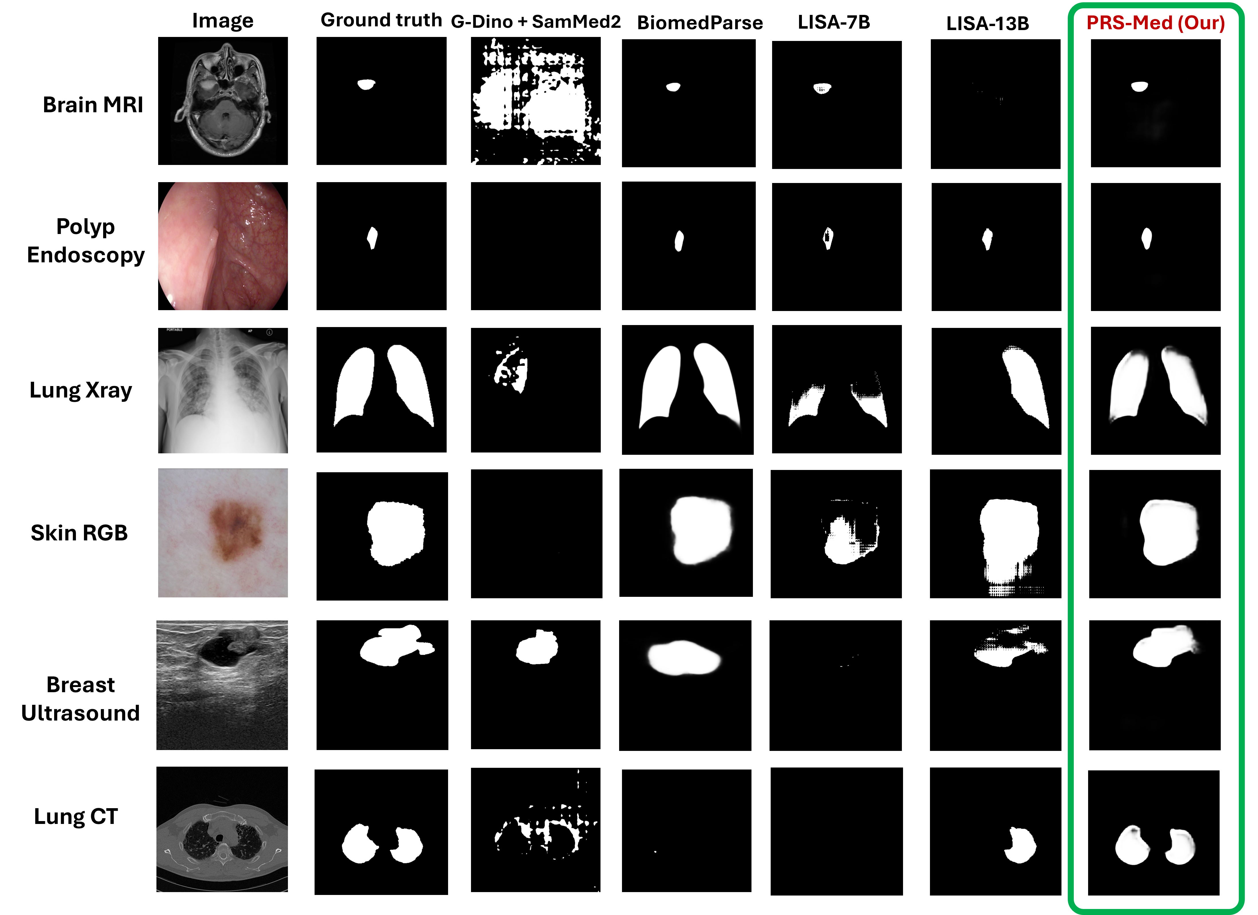PRS-Med qualitative segmentation results across modalities