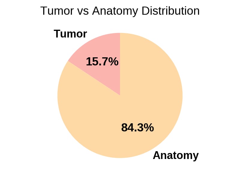 Tumor vs anatomy-centric QA distribution